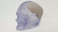 The Case for Point-of-Care 3D Printing