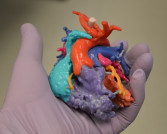 3DHEART: 3D Printing Surgical Planning Models for Tiny Patients