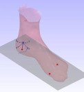 3D Printing Keeps People on Their Feet