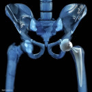 New Titanium Alloy Modeling Capabilities