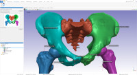 Simpleware Automated Segmentation Coming Soon
