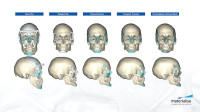 3D Printing Challenges in Healthcare
