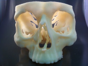 Medical 3D Printing Expands in the UK