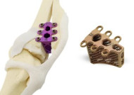 3D Printed Titanium Implants for Man’s Best Friend